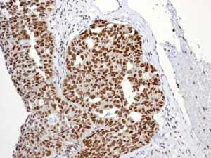 Immunohistochemistry (Formalin/PFA-fixed paraffin-embedded sections) - Anti-Nrf2 (phospho S40) antibody [EP1809Y] (AB76026)