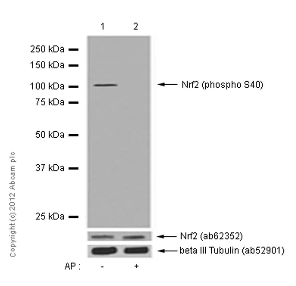 Western blot - Anti-Nrf2 (phospho S40) antibody [EP1809Y] (AB76026)