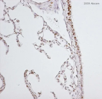 Immunohistochemistry (Formalin/PFA-fixed paraffin-embedded sections) - Anti-Nrf2 (phospho S40) antibody [EP1809Y] - BSA and Azide free (AB180844)