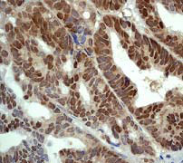 Immunohistochemistry (Formalin/PFA-fixed paraffin-embedded sections) - Anti-Nrf2 (phospho S40) antibody [EP1809Y] - BSA and Azide free (AB180844), expandable thumbnail