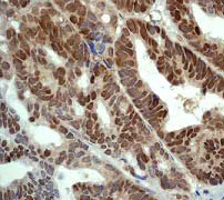 Immunohistochemistry (Formalin/PFA-fixed paraffin-embedded sections) - Anti-Nrf2 (phospho S40) antibody [EP1809Y] - BSA and Azide free (AB180844)