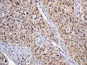 Immunohistochemistry (Formalin/PFA-fixed paraffin-embedded sections) - Anti-Nrf2 (phospho S40) antibody [EP1809Y] - BSA and Azide free (AB180844)