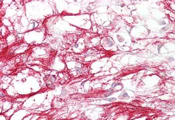 Immunohistochemistry (Formalin/PFA-fixed paraffin-embedded sections) - Anti-NRG1 antibody (AB133712)