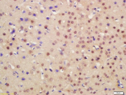 Immunohistochemistry (Formalin/PFA-fixed paraffin-embedded sections) - Anti-NRG1 antibody (AB217805), expandable thumbnail