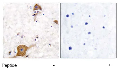 Immunohistochemistry (Formalin/PFA-fixed paraffin-embedded sections) - Anti-NRG1 antibody (AB53104)
