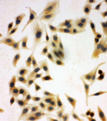 Immunocytochemistry - Anti-NRG1 antibody - C-terminal (AB191139), expandable thumbnail