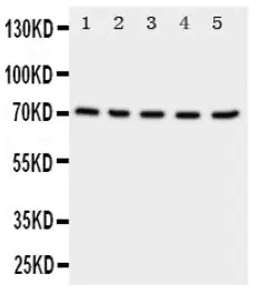 Western blot - Anti-NRG1 antibody - C-terminal (AB191139), expandable thumbnail
