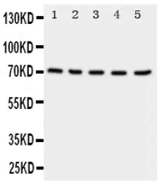 Western blot - Anti-NRG1 antibody - C-terminal (AB191139)