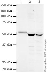 Western blot - Anti-NRG1 type III antibody (AB23248), expandable thumbnail
