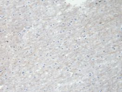 Immunohistochemistry (Formalin/PFA-fixed paraffin-embedded sections) - Anti-NRG4 antibody [C2] (AB239580), expandable thumbnail