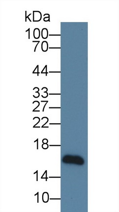 Western blot - Anti-NRG4 antibody [C2] (AB239580), expandable thumbnail