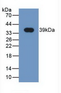 Western blot - Anti-NRG4 antibody [C2] (AB239580), expandable thumbnail