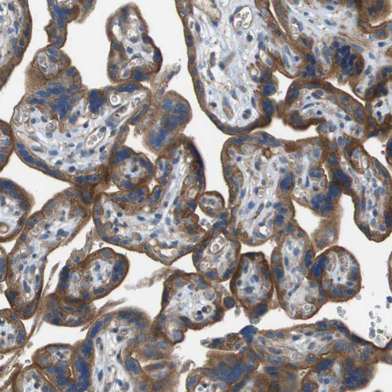 Immunohistochemistry (Formalin/PFA-fixed paraffin-embedded sections) - Anti-NRK antibody (AB224394), expandable thumbnail