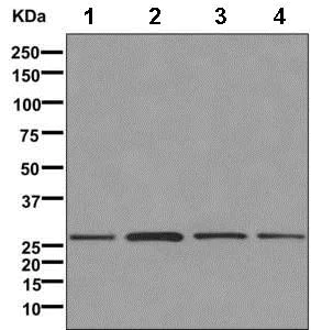Western blot - Anti-NRK1 antibody [EPR11190] (AB169548)