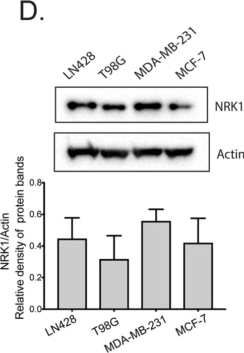 Western blot - Anti-NRK1 antibody [EPR11190] (AB169548)