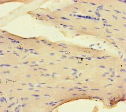 Immunohistochemistry (Formalin/PFA-fixed paraffin-embedded sections) - Anti-NRP2 antibody (AB234821)