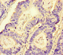 Immunohistochemistry (Formalin/PFA-fixed paraffin-embedded sections) - Anti-NRP2 antibody (AB234821)