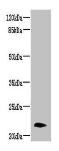 Western blot - Anti-NRSN2 antibody (AB237739)