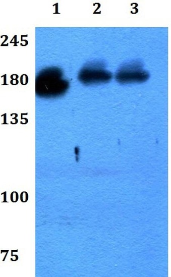 Western blot - Anti-NRXN3 antibody (AB192313), expandable thumbnail