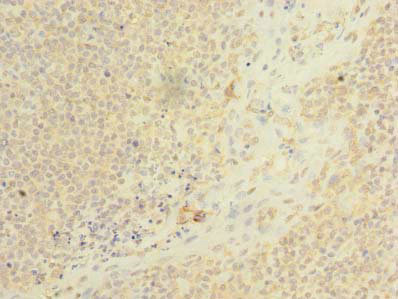 Immunohistochemistry (Formalin/PFA-fixed paraffin-embedded sections) - Anti-NS21 antibody (AB235416), expandable thumbnail