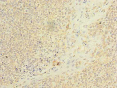 Immunohistochemistry (Formalin/PFA-fixed paraffin-embedded sections) - Anti-NS21 antibody (AB235416)