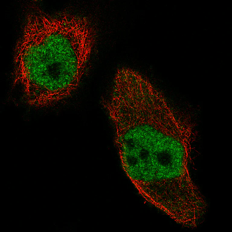 Immunocytochemistry/ Immunofluorescence - Anti-NSD2 Antibody [CL1057] (AB327104)