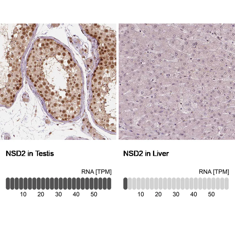 Immunohistochemistry (Formalin/PFA-fixed paraffin-embedded sections) - Anti-NSD2 Antibody [CL1057] (AB327104)