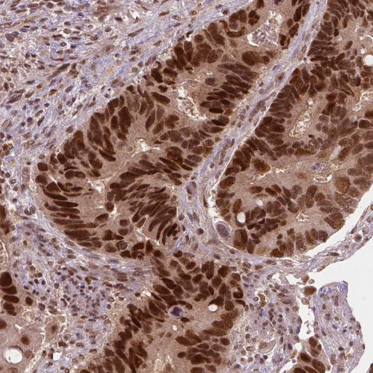 Immunohistochemistry (Formalin/PFA-fixed paraffin-embedded sections) - Anti-NSD2 Antibody [CL1057] (AB327104)