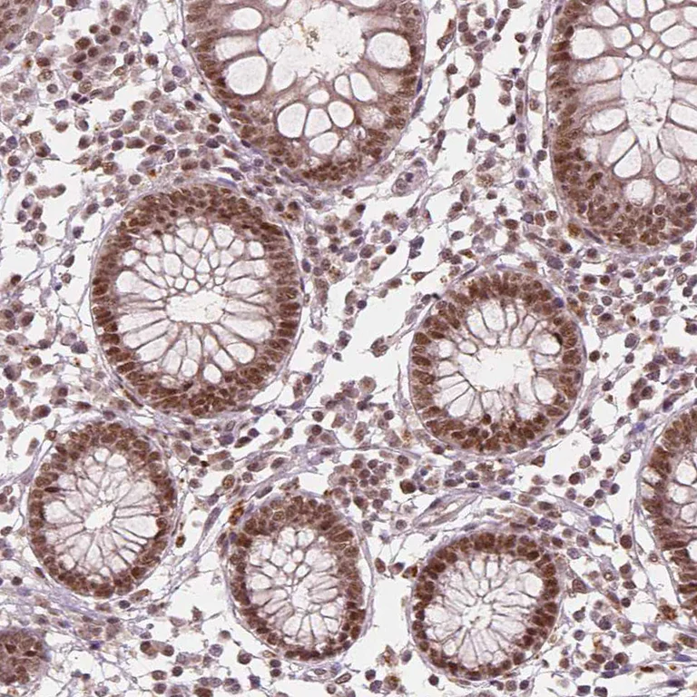 Immunohistochemistry (Formalin/PFA-fixed paraffin-embedded sections) - Anti-NSD2 Antibody [CL1057] (AB327104)