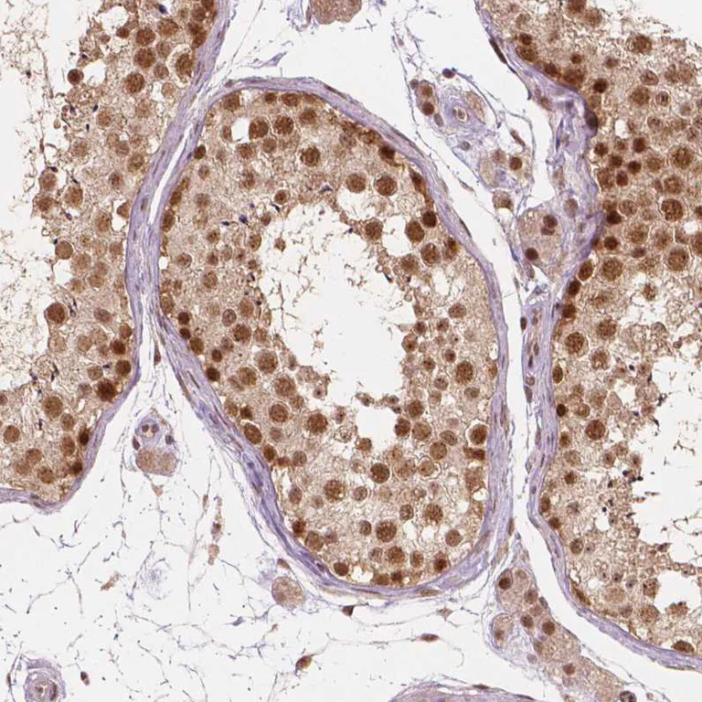 Immunohistochemistry (Formalin/PFA-fixed paraffin-embedded sections) - Anti-NSD2 Antibody [CL1057] (AB327104)