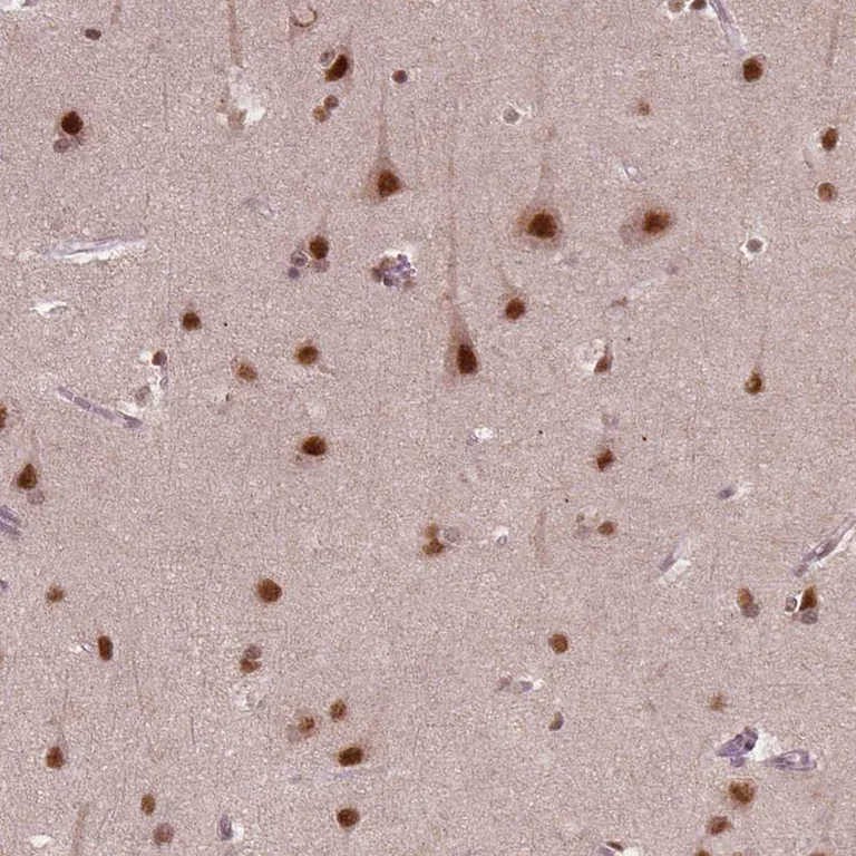 Immunohistochemistry (Formalin/PFA-fixed paraffin-embedded sections) - Anti-NSD2 Antibody [CL1057] (AB327104)