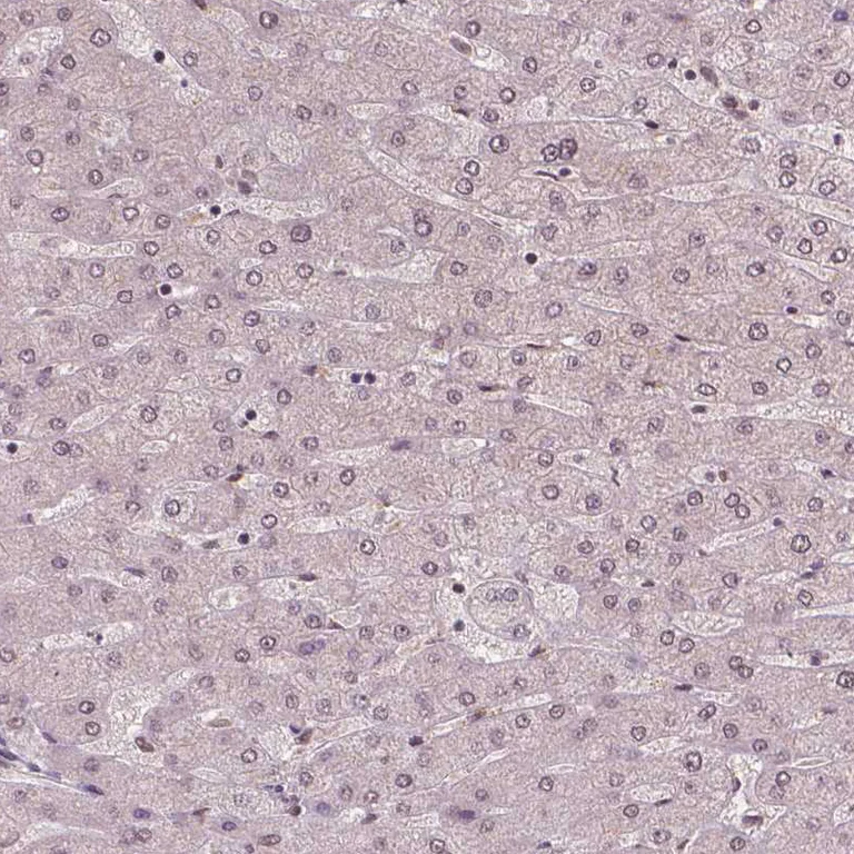 Immunohistochemistry (Formalin/PFA-fixed paraffin-embedded sections) - Anti-NSD2 Antibody [CL1057] (AB327104)