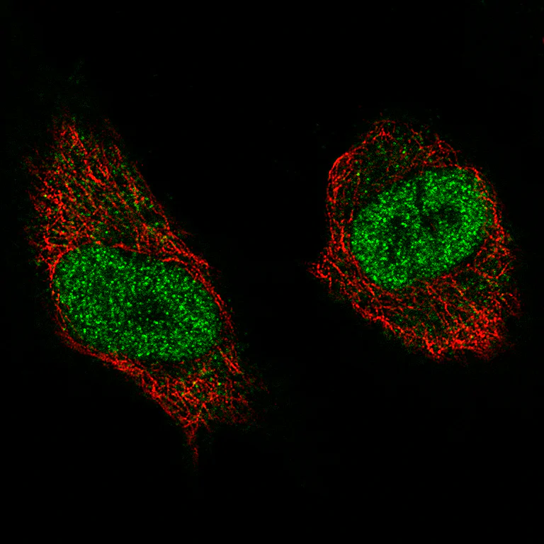 Immunocytochemistry/ Immunofluorescence - Anti-NSD2 Antibody [CL1063] (AB327105)