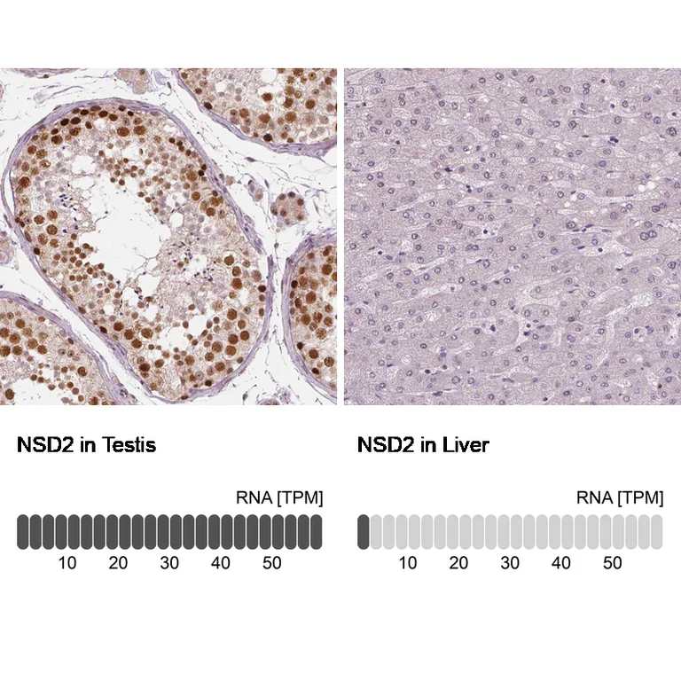 Immunohistochemistry (Formalin/PFA-fixed paraffin-embedded sections) - Anti-NSD2 Antibody [CL1063] (AB327105)