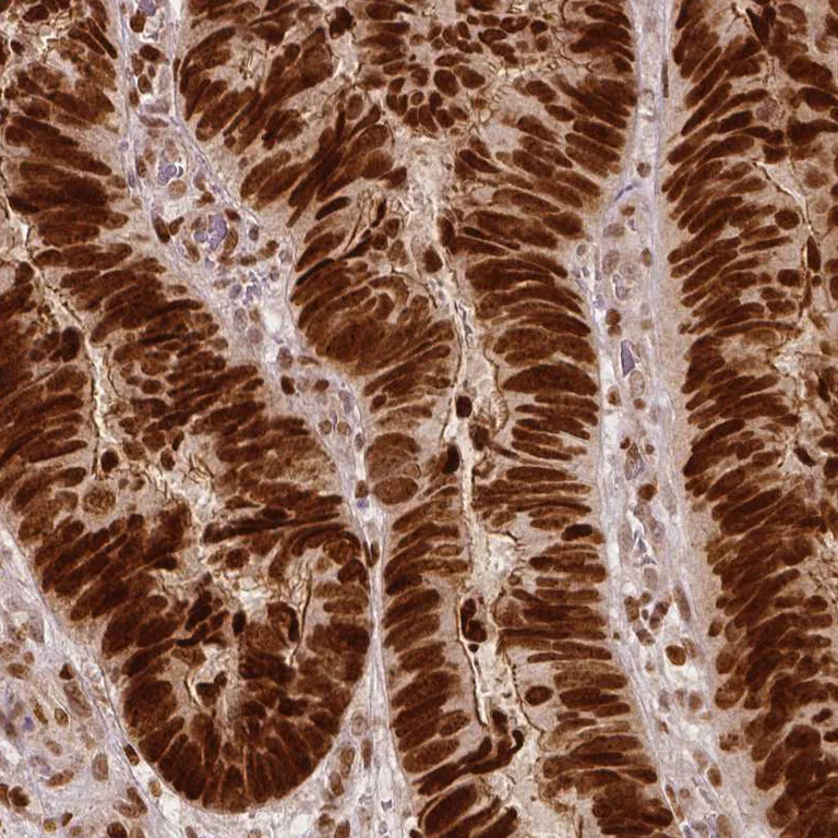 Immunohistochemistry (Formalin/PFA-fixed paraffin-embedded sections) - Anti-NSD2 Antibody [CL1063] (AB327105)