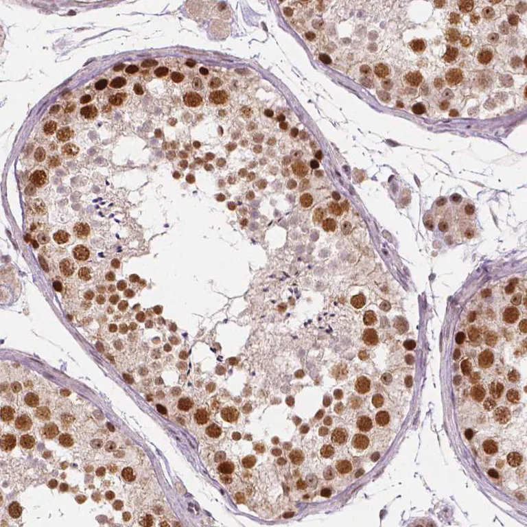 Immunohistochemistry (Formalin/PFA-fixed paraffin-embedded sections) - Anti-NSD2 Antibody [CL1063] (AB327105)
