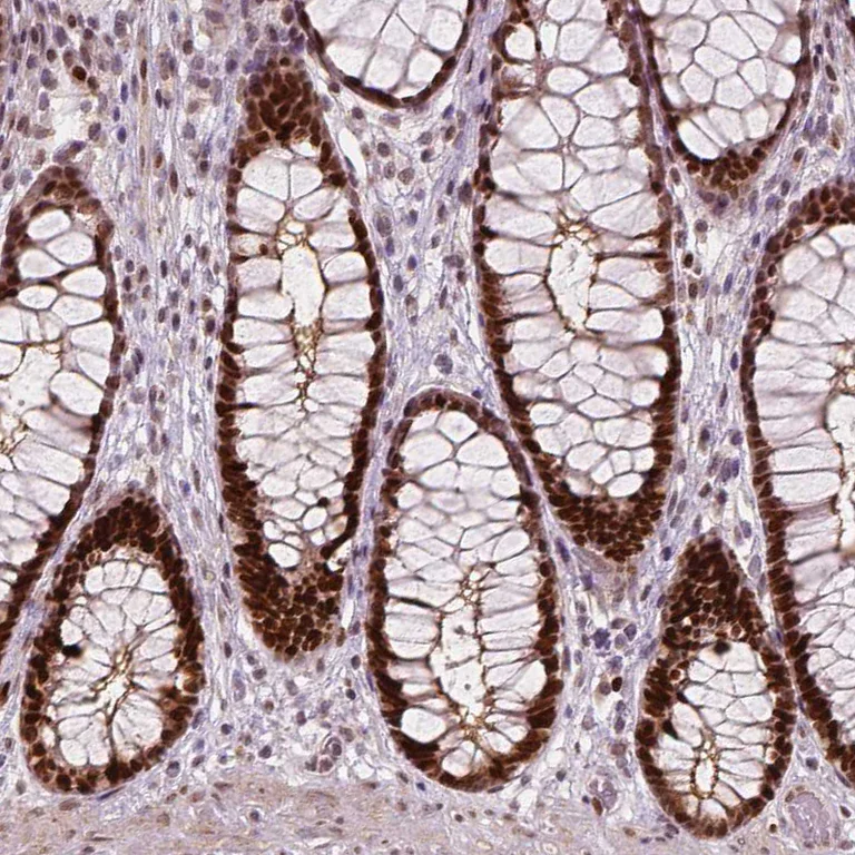 Immunohistochemistry (Formalin/PFA-fixed paraffin-embedded sections) - Anti-NSD2 Antibody [CL1063] (AB327105)