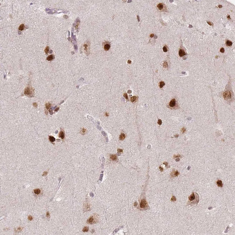 Immunohistochemistry (Formalin/PFA-fixed paraffin-embedded sections) - Anti-NSD2 Antibody [CL1063] (AB327105)