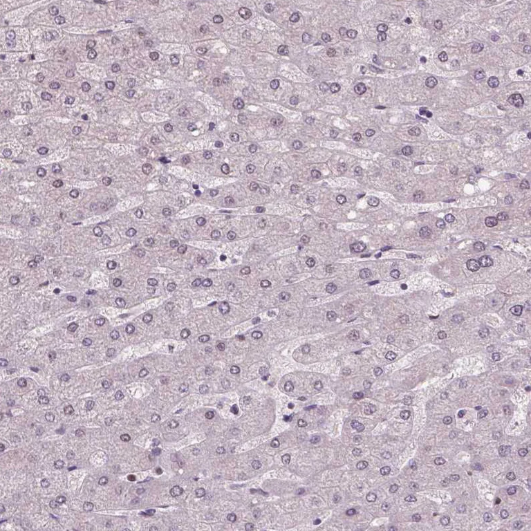Immunohistochemistry (Formalin/PFA-fixed paraffin-embedded sections) - Anti-NSD2 Antibody [CL1063] (AB327105)