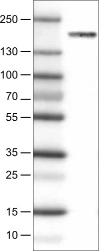 Western blot - Anti-NSD2 Antibody [CL1063] (AB327105)