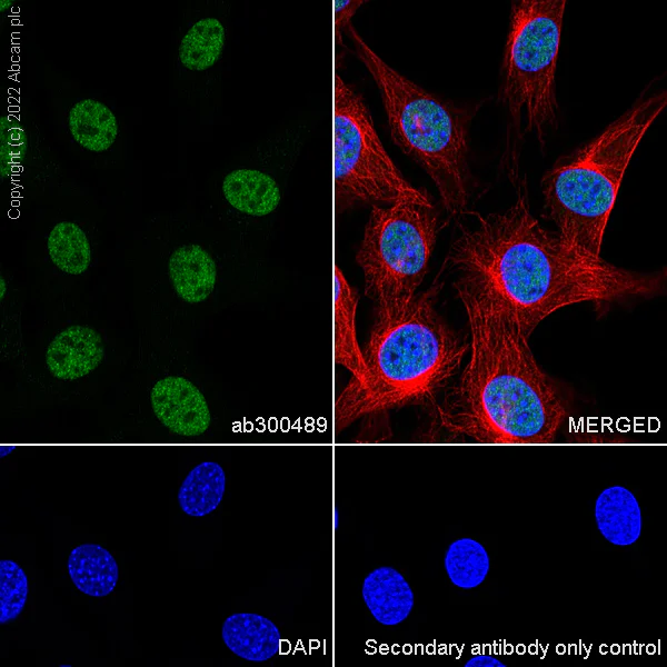 Immunocytochemistry/ Immunofluorescence - Anti-NSD3 antibody [EPR25189-8] (BSA and Azide free) (AB300490)