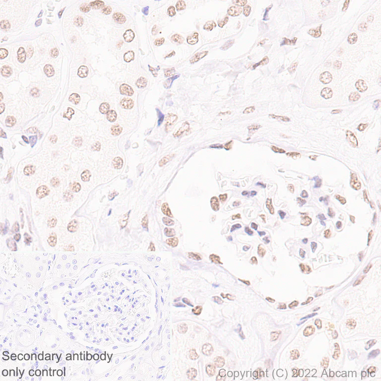 Immunohistochemistry (Formalin/PFA-fixed paraffin-embedded sections) - Anti-NSD3 antibody [EPR25189-8] (BSA and Azide free) (AB300490)