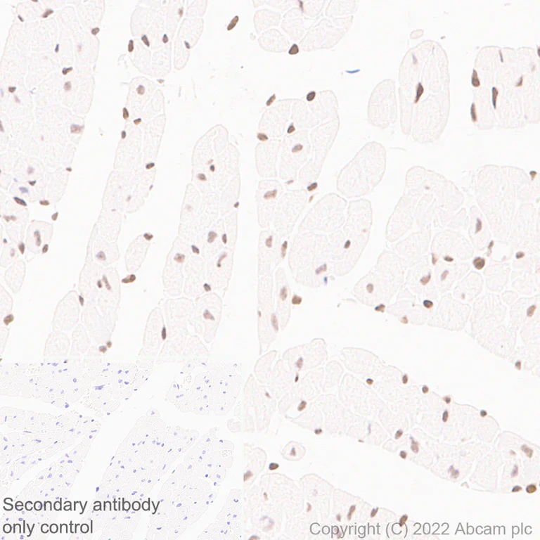 Immunohistochemistry (Formalin/PFA-fixed paraffin-embedded sections) - Anti-NSD3 antibody [EPR25189-8] (BSA and Azide free) (AB300490)