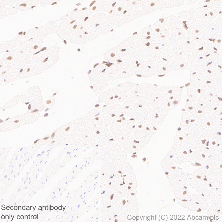 Immunohistochemistry (Formalin/PFA-fixed paraffin-embedded sections) - Anti-NSD3 antibody [EPR25189-8] (BSA and Azide free) (AB300490)