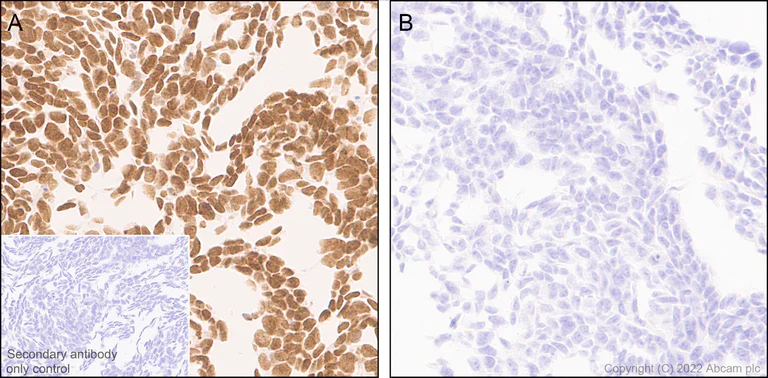 Immunohistochemistry (Formalin/PFA-fixed paraffin-embedded sections) - Anti-NSD3 antibody [EPR25189-8] (BSA and Azide free) (AB300490)