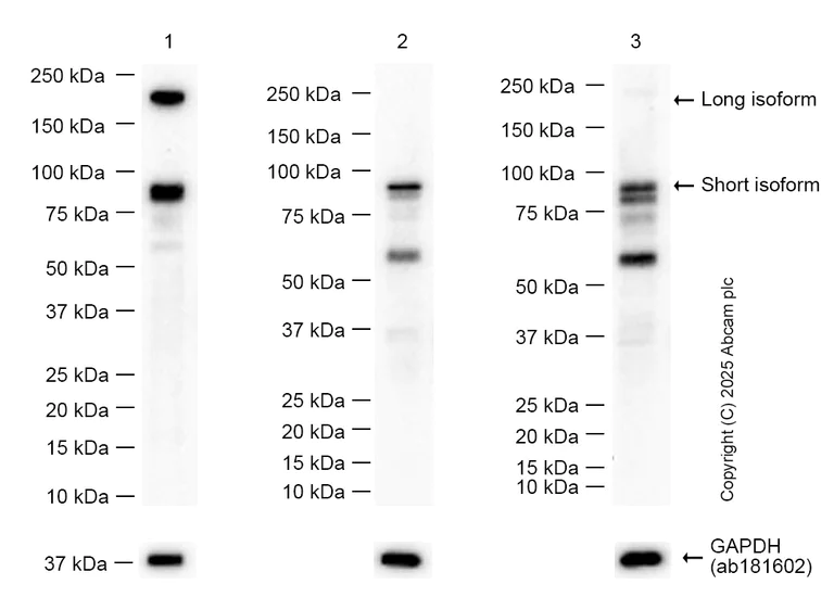 Western blot - Anti-NSD3 antibody [EPR25189-8] (BSA and Azide free) (AB300490)