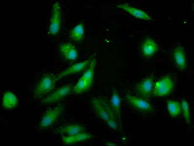 Immunocytochemistry/ Immunofluorescence - Anti-NSDHL antibody (AB237799)