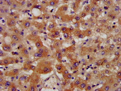 Immunohistochemistry (Formalin/PFA-fixed paraffin-embedded sections) - Anti-NSDHL antibody (AB237799)