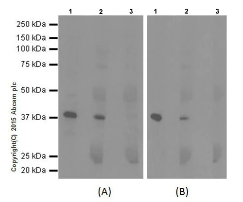 Immunoprecipitation - Anti-NSDHL antibody [EPR14489(2)] (AB199730)