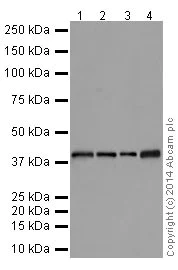 Western blot - Anti-NSDHL antibody [EPR14489(2)] (AB199730)